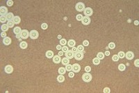 Figure  5.) Cryptococcus neoformans, a radiotrophic fungus that can be found inside the Chernobyl reactor (Wikipedia)